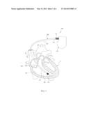 IMPLANTABLE LEAD HAVING A LUMEN WITH A WEAR-RESISTANT LINER diagram and image