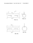 IMPLANTABLE MEDICAL DEVICES diagram and image