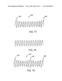 IMPLANTABLE MEDICAL DEVICES diagram and image