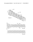 IMPLANTABLE MEDICAL DEVICES diagram and image