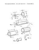 IMPLANTABLE MEDICAL DEVICES diagram and image