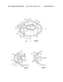 INTRAOCULAR, ACCOMMODATING LENS AND METHODS OF USE diagram and image