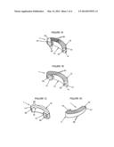 TRANSFORAMINAL INTERSOMATIC CAGE FOR AN INTERVERTEBRAL FUSION GRAFT AND AN     INSTRUMENT FOR IMPLANTING THE CAGE diagram and image