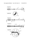 TRANSFORAMINAL INTERSOMATIC CAGE FOR AN INTERVERTEBRAL FUSION GRAFT AND AN     INSTRUMENT FOR IMPLANTING THE CAGE diagram and image