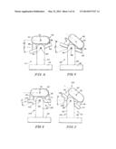 PRONE AND LATERALLY ANGLED SURGICAL DEVICE AND METHOD diagram and image