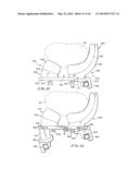 PRONE AND LATERALLY ANGLED SURGICAL DEVICE AND METHOD diagram and image