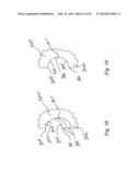 Archery Sight for a Bow for Shooting Arrows diagram and image