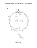 Stovepipe Damper System diagram and image