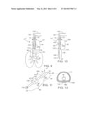 SECRETION CLEARING PATIENT AIRWAY MANAGEMENT SYSTEM diagram and image