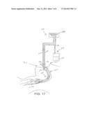 SECRETION CLEARING PATIENT AIRWAY MANAGEMENT SYSTEM diagram and image