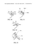 PAP SYSTEM diagram and image