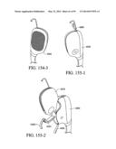 PAP SYSTEM diagram and image