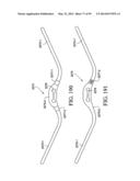 PAP SYSTEM diagram and image