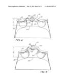 FOREHEAD SUPPORT FOR A FACIAL MASK diagram and image