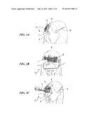 ASSIST DEVICE FOR CUTTING BANGS diagram and image