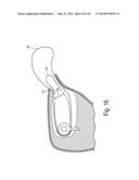BAG-IN-BAG SAFETY RESTRAINT WITH DIRECTIONAL INFLATION diagram and image
