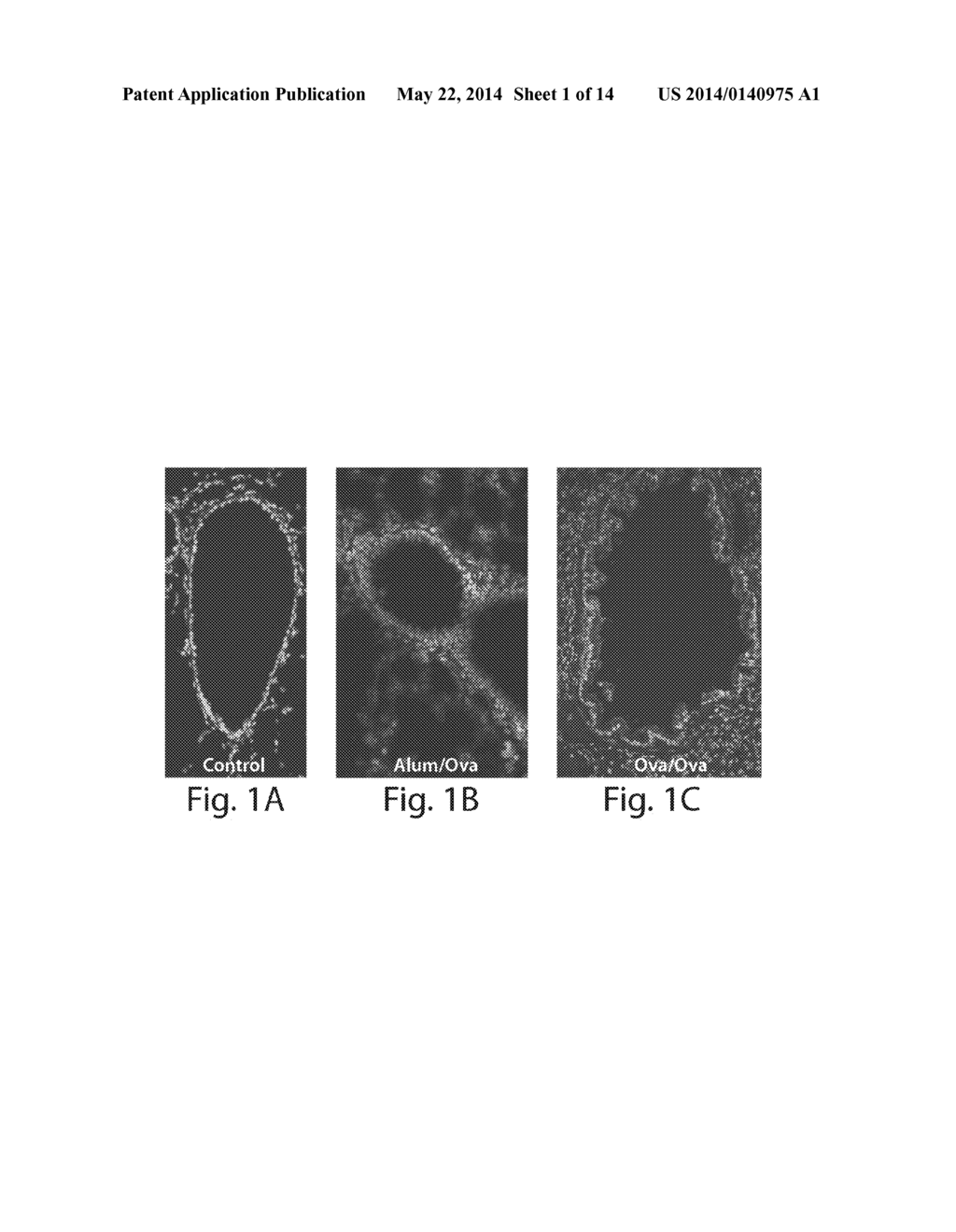 TREATMENTS INVOLVING GLUTAREDOXINS AND SIMILAR AGENTS - diagram, schematic, and image 02