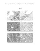 CLEAVAGE INHIBITORS OF TRANSFORMING GROWTH FACTOR BETA TYPE I RECEPTOR AND     USES THEREOF IN CANCER THERAPY diagram and image