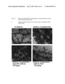 NEUTRALIZING PROLACTIN RECEPTOR ANTIBODY MAT3 AND ITS THERAPEUTIC USE diagram and image