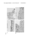 USE OF ANTAGONISTS TARGETING METALLOTHIONEIN TO TREAT INTESTINAL     INFLAMMATION diagram and image