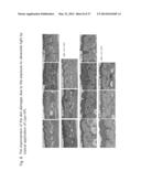 METHOD AND COMPOSITION FOR IMPROVING SKIN CONDITIONS COMPRISING HUMAN     PLACENTAL LACTOGEN AS AN ACTIVE INGREDIENT diagram and image