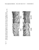 METHOD AND COMPOSITION FOR IMPROVING SKIN CONDITIONS COMPRISING HUMAN     PLACENTAL LACTOGEN AS AN ACTIVE INGREDIENT diagram and image