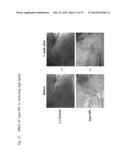 METHOD AND COMPOSITION FOR IMPROVING SKIN CONDITIONS COMPRISING HUMAN     PLACENTAL LACTOGEN AS AN ACTIVE INGREDIENT diagram and image