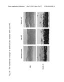 METHOD AND COMPOSITION FOR IMPROVING SKIN CONDITIONS COMPRISING HUMAN     PLACENTAL LACTOGEN AS AN ACTIVE INGREDIENT diagram and image