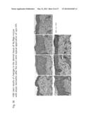 METHOD AND COMPOSITION FOR IMPROVING SKIN CONDITIONS COMPRISING HUMAN     PLACENTAL LACTOGEN AS AN ACTIVE INGREDIENT diagram and image