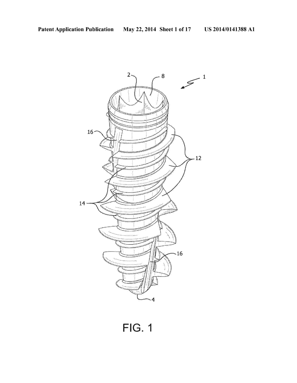 Dental Implant and Method of Implantation - diagram, schematic, and image 02