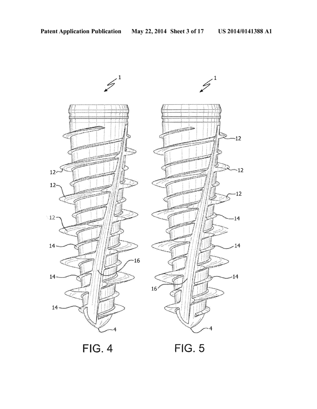 Dental Implant and Method of Implantation - diagram, schematic, and image 04