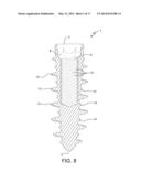 Dental Implant and Method of Implantation diagram and image