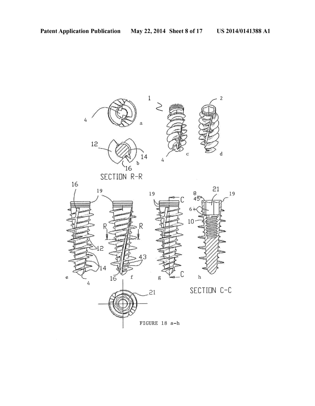 Dental Implant and Method of Implantation - diagram, schematic, and image 09