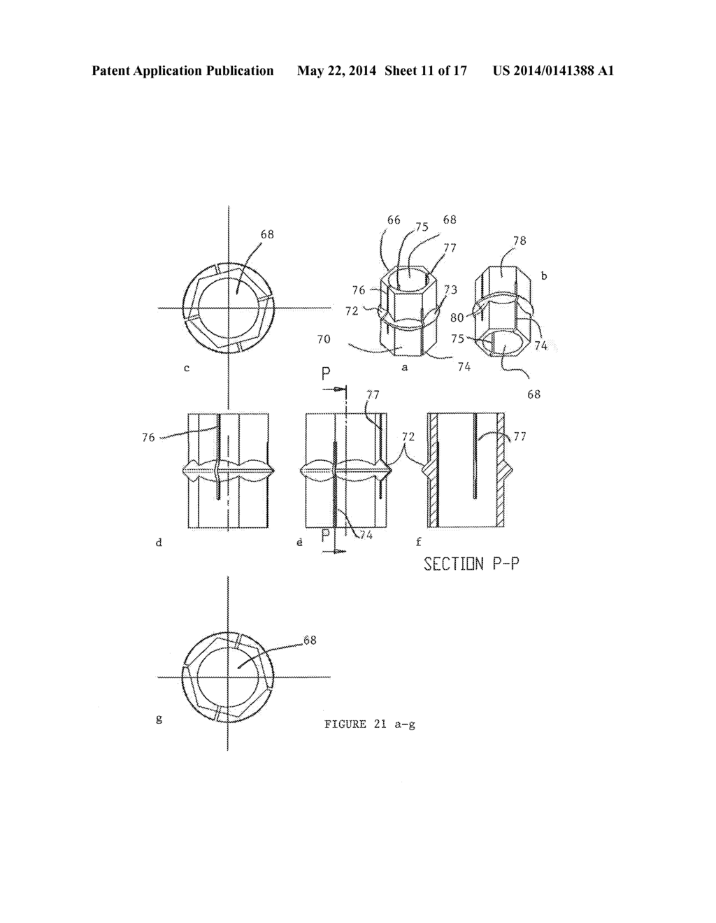 Dental Implant and Method of Implantation - diagram, schematic, and image 12