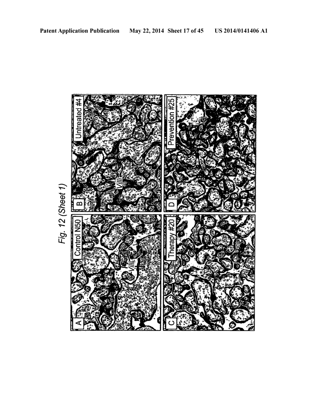 BIOMARKERS FOR PRENATAL DIAGNOSIS OF CONGENITAL CYTOMEGALOVIRUS - diagram, schematic, and image 18