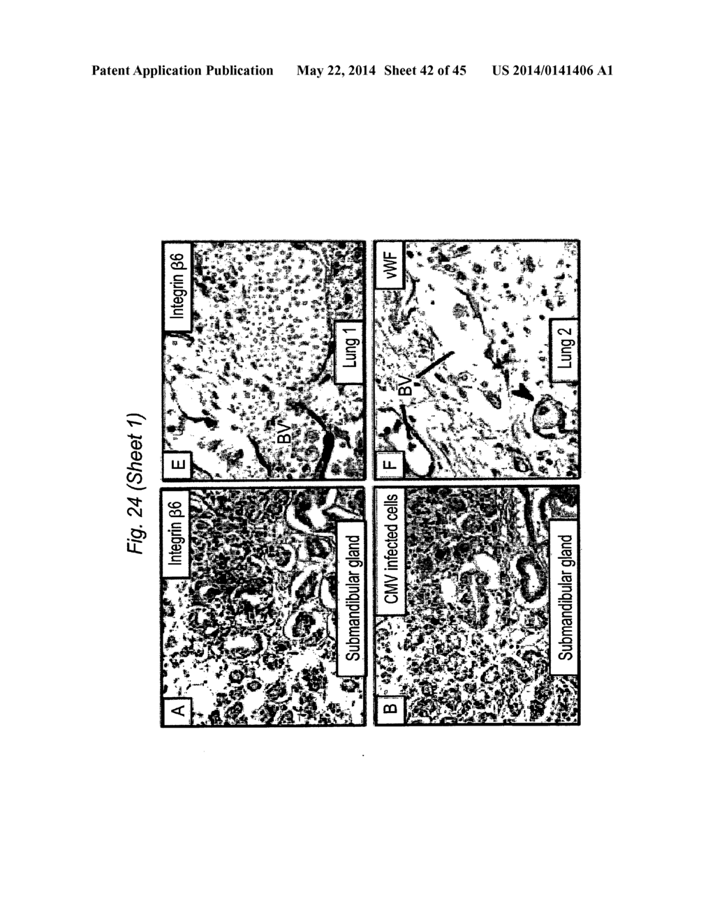 BIOMARKERS FOR PRENATAL DIAGNOSIS OF CONGENITAL CYTOMEGALOVIRUS - diagram, schematic, and image 43