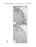 METHODS OF TREATING CANCER WITH GLUT INHIBITORS AND OXIDATIVE     PHOSPHORYLATION INHIBITORS diagram and image