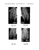 PROSTAGLANDIN COMPOSITIONS AND METHODS FOR THE TREATMENT OF VASOSPASM diagram and image