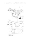 REPROCESSING OF A PHYSIOLOGICAL SENSOR diagram and image