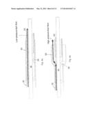 Automated Fluid Delivery Catheter and System diagram and image