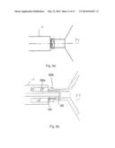 Automated Fluid Delivery Catheter and System diagram and image