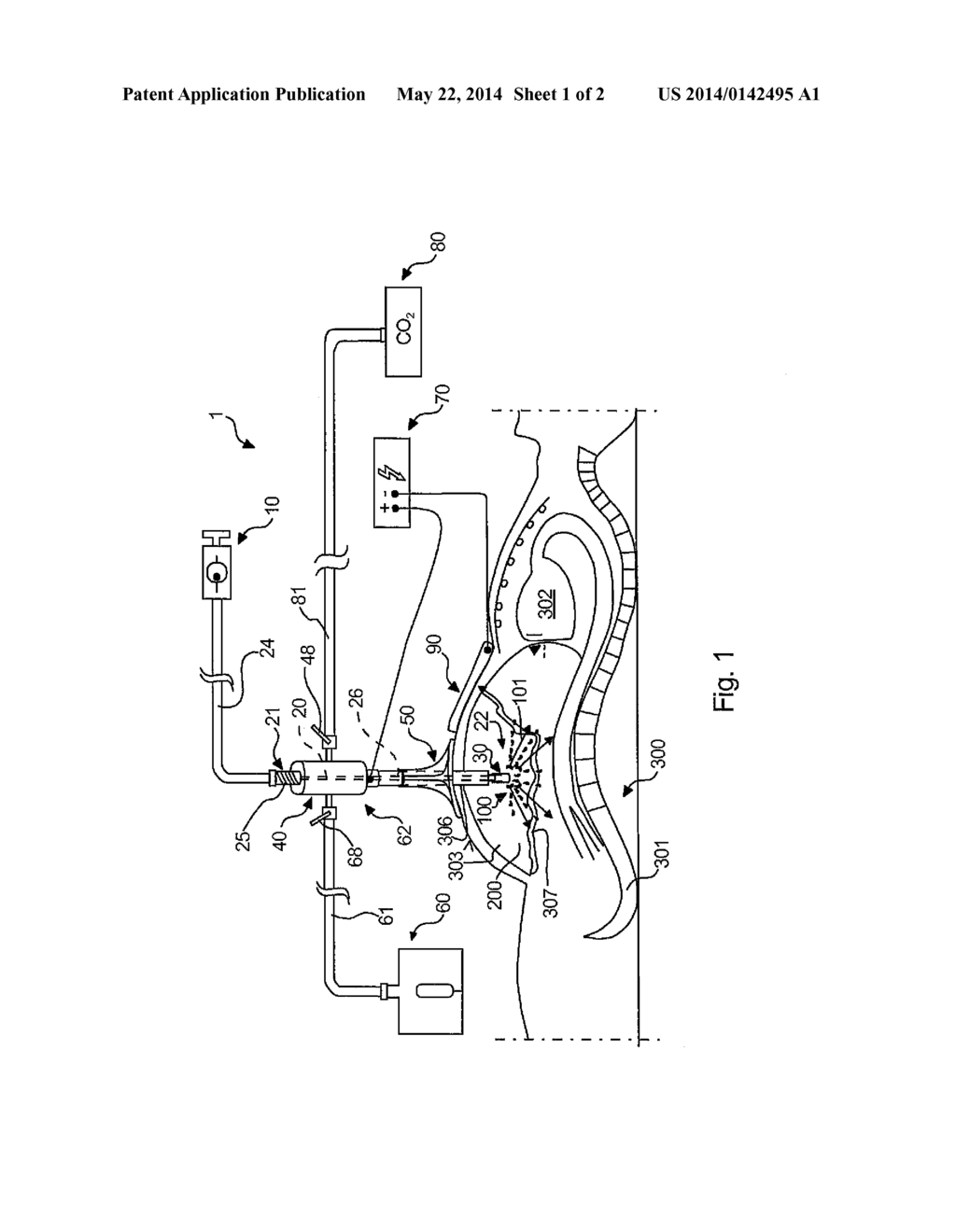 SURGICAL DEVICE FOR USE IN LAPAROSCOPY - diagram, schematic, and image 02