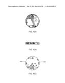 Infusion Pump Assembly diagram and image