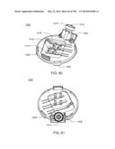 Infusion Pump Assembly diagram and image