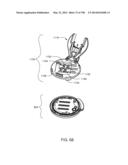 Infusion Pump Assembly diagram and image