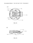 Infusion Pump Assembly diagram and image