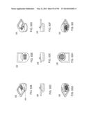 Infusion Pump Assembly diagram and image