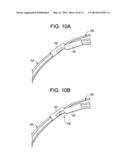 Minimally Invasive Method for Coronary Bypass and Other Treatments diagram and image