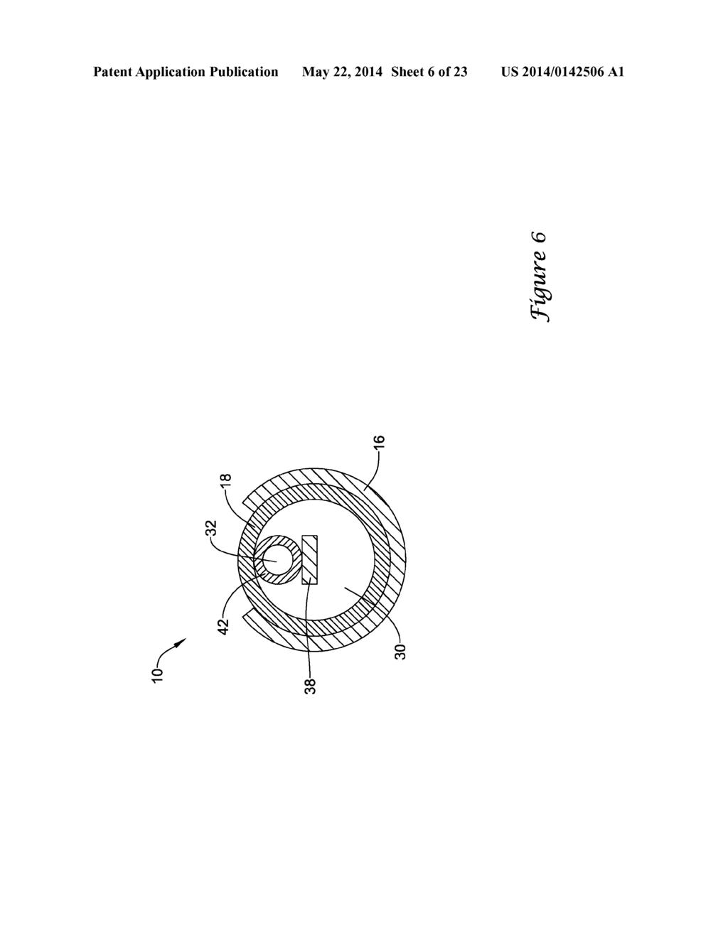 BALLOON CATHETER WITH IMPROVED PUSHABILITY - diagram, schematic, and image 07