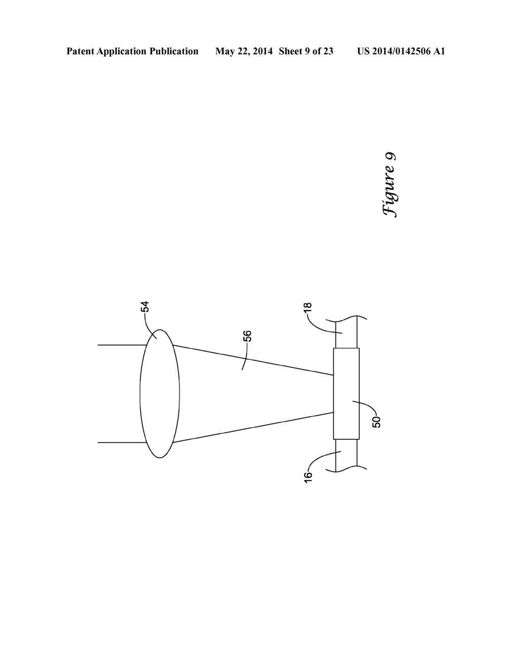 BALLOON CATHETER WITH IMPROVED PUSHABILITY - diagram, schematic, and image 10